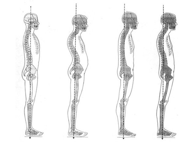 What is the ideal spinal alignment?