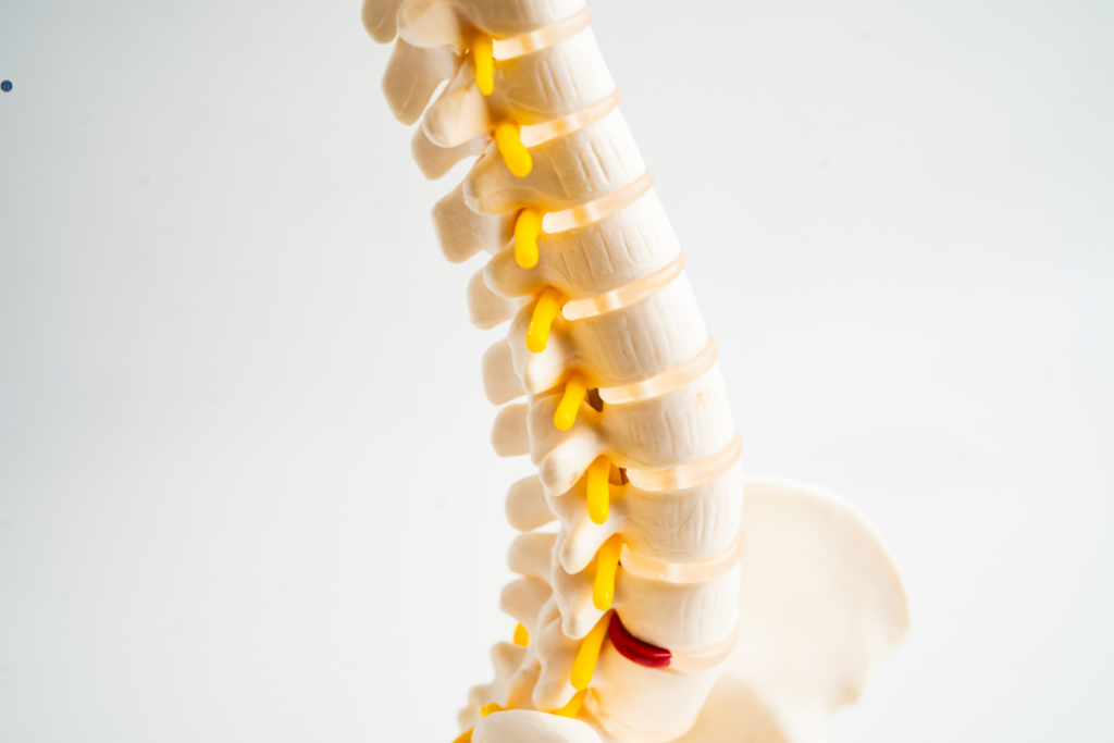 Chiropractor in Dee Why treating spinal degeneration