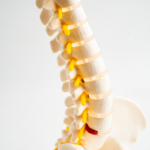 Chiropractor in Dee Why treating spinal degeneration